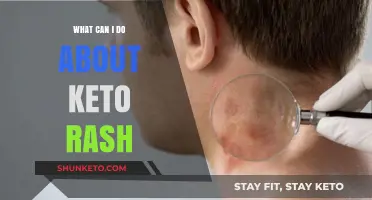 Effective Remedies and Tips to Combat Keto Rash Naturally