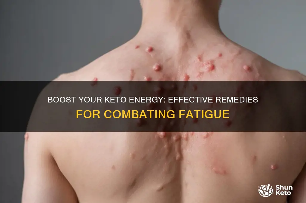what can i take for low energy loss on keto