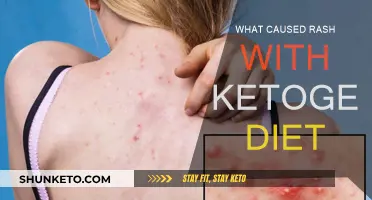 Ketogenic Diet: Rash Reaction and Causes