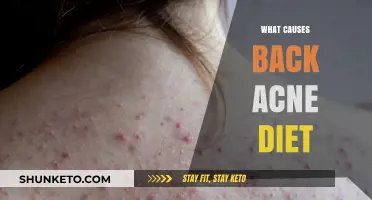 Diet-Related Back Acne: What You Need to Know