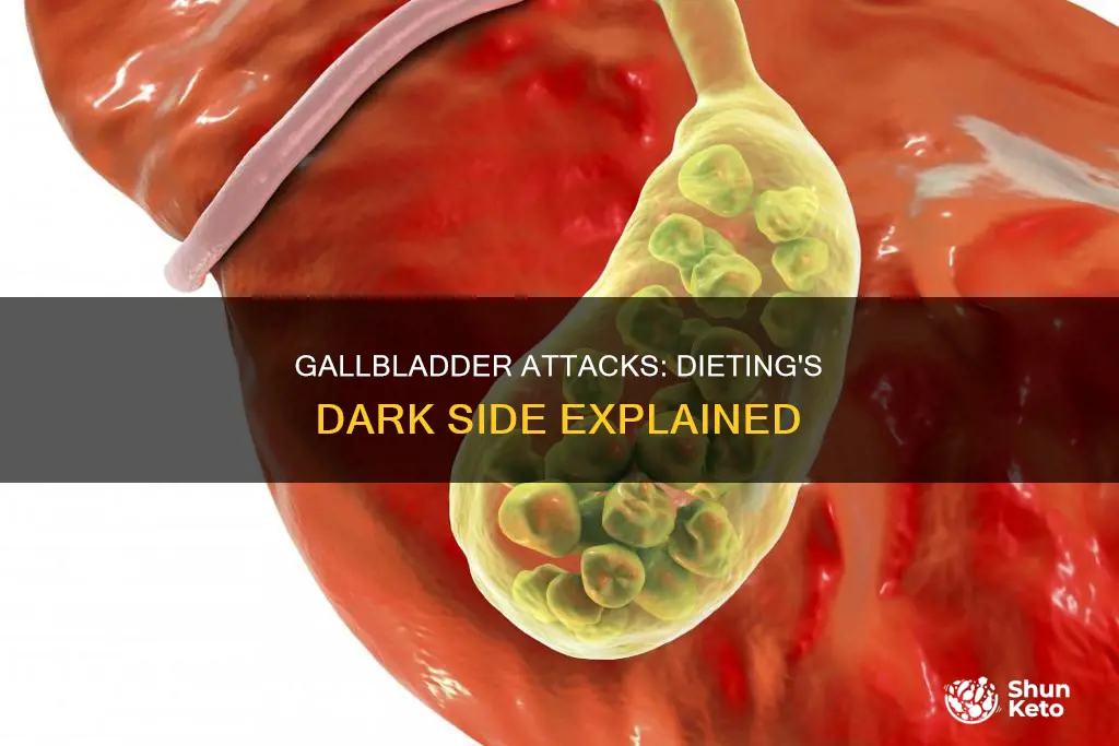 what causes gallbladder attacks while dieting