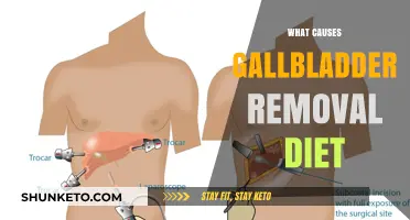 Gallbladder Diet: Foods to Eat and Avoid After Surgery