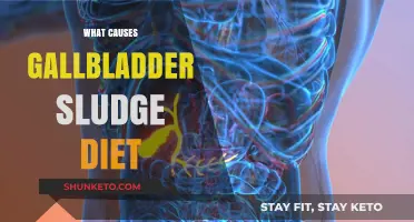 Gallbladder Sludge: Dietary Causes and Prevention