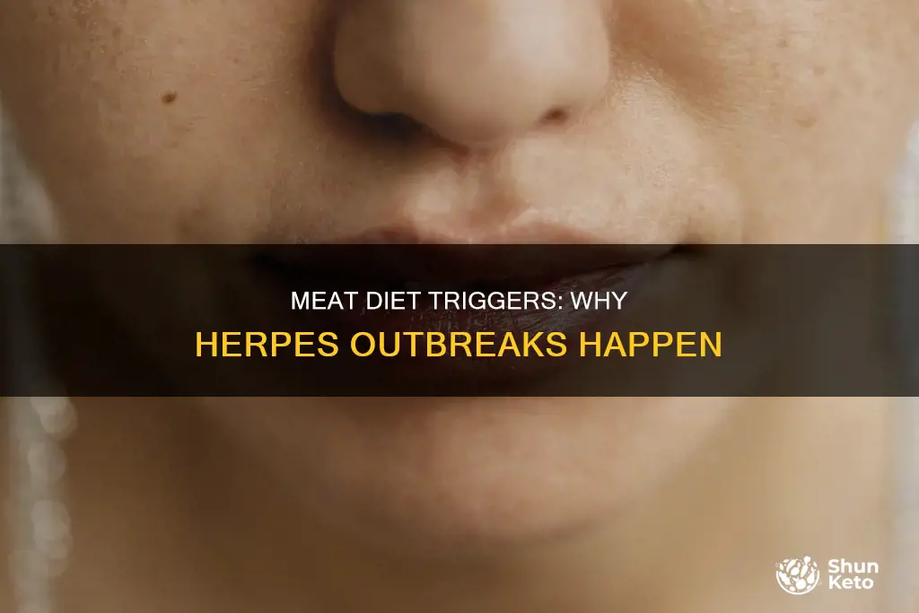 what causes herpes outbreak diet meat