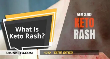 Understanding the Triggers of Keto Rash