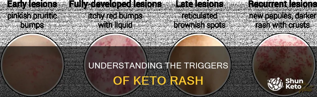 what causes keto rash