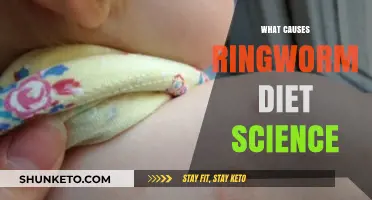 Ringworm: Diet, Science, and Causes