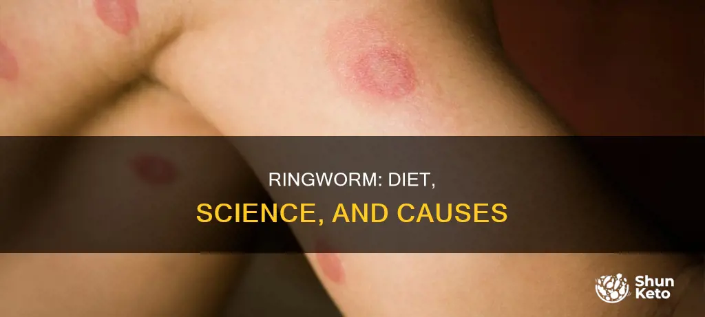 what causes ringworm diet science