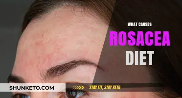 Rosacea Triggers: The Diet Connection