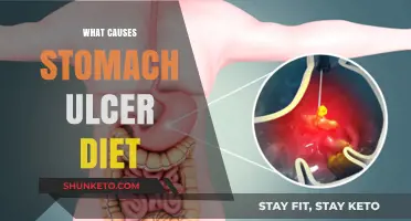 Stomach Ulcers: Diet and Triggers