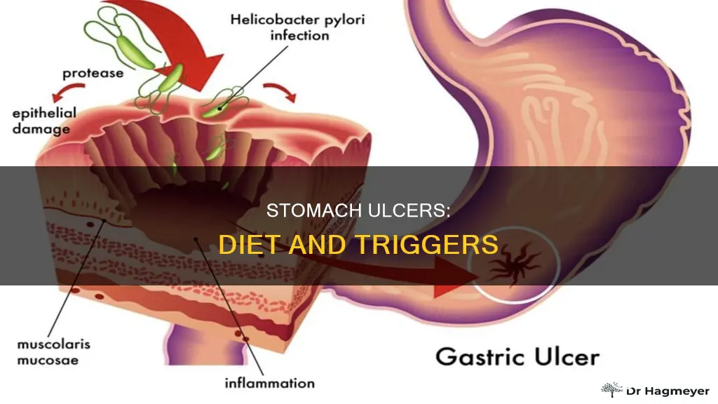 what causes stomach ulcer diet