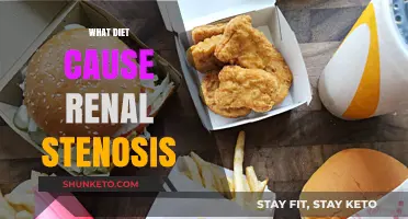 Diet-Induced Renal Stenosis: What You Need to Know