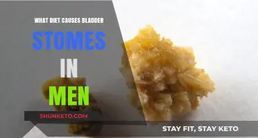 Diet-Induced Bladder Stones: What Men Should Avoid