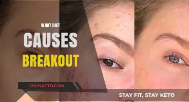 Diet and Breakouts: What You Eat Matters