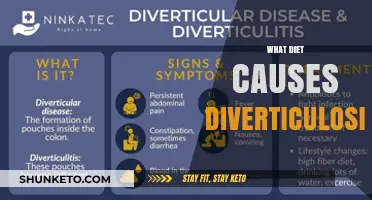 Diet and Diverticulosis: What You Need to Know