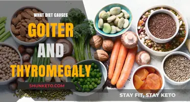 Goiter and Thyromegaly: Dietary Triggers and Risks