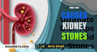 Diet and Kidney Stones: What You Need to Know