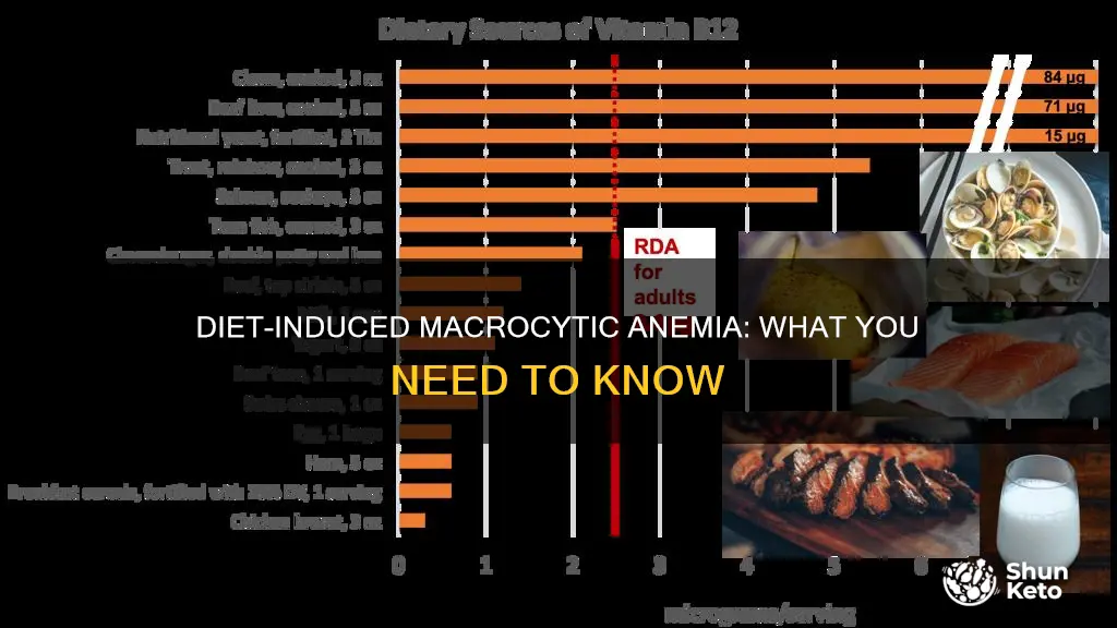 what diet causes macrocytic anemia
