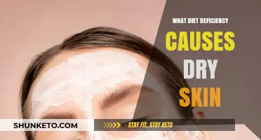 Skin Hydration: Diet Deficiency and Dry Skin