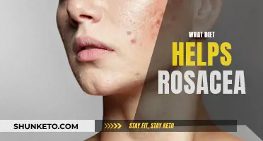 Anti-Inflammatory Diets: A Rosacea Treatment?
