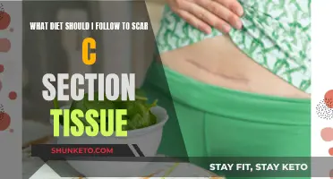 Healing C-Section Scars: The Dietary Approach