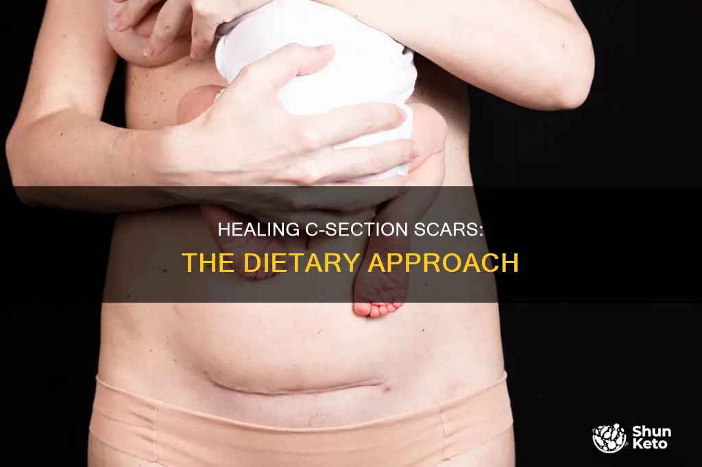 what diet should i follow to scar c section tissue