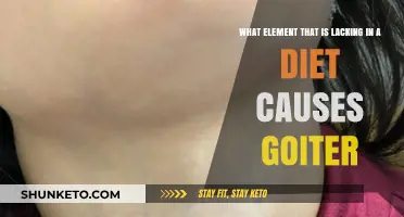 Iodine Deficiency: The Cause of Goiter