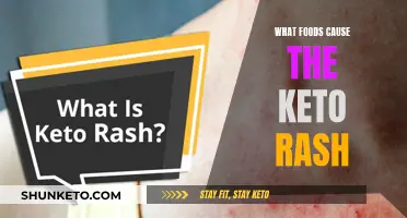 Keto Rash: Foods to Avoid and Why