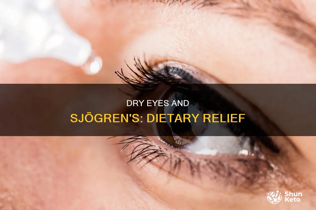 what help my dry eyes sjogens diet