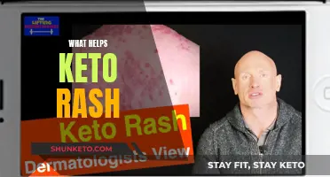 Treating Keto Rash: Natural Remedies and Tips