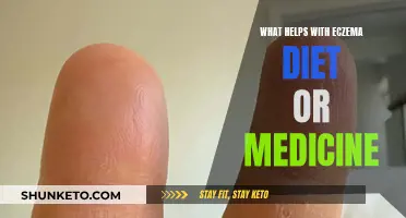 Eczema: Diet, Medicine, and You