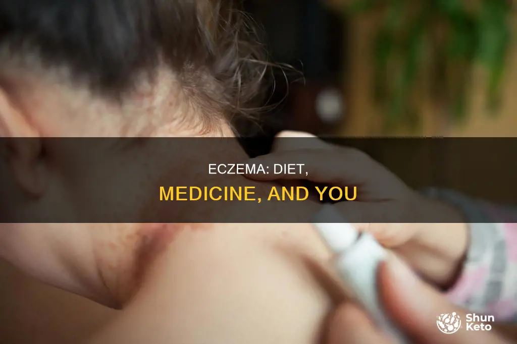 what helps with eczema diet or medicine