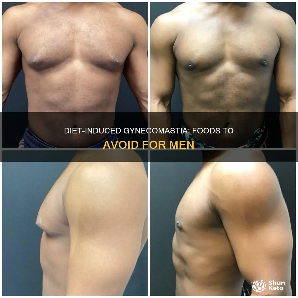 what in the diet makes man boobs