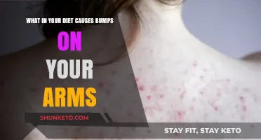 Foods Causing Bumps on Your Arms