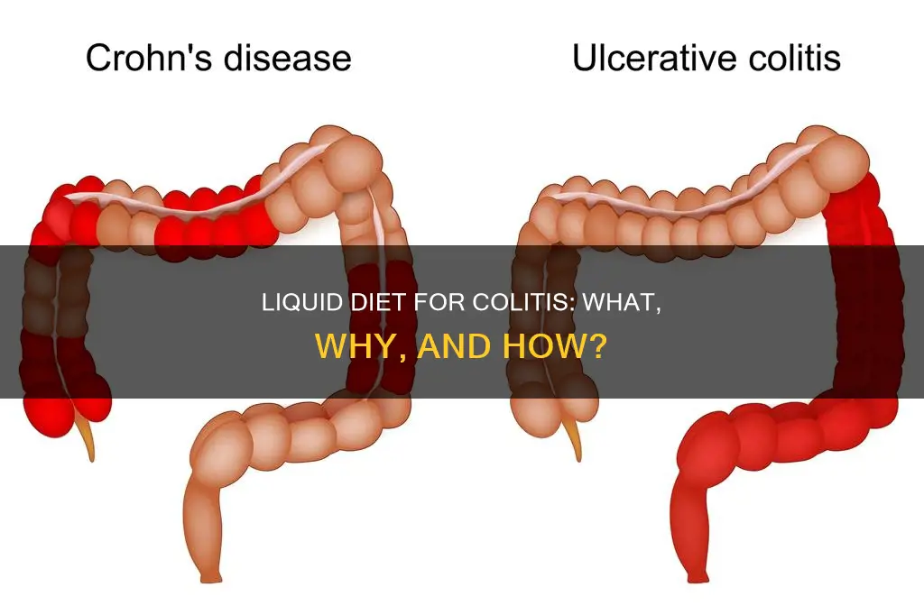 what is a liquid diet for colitis
