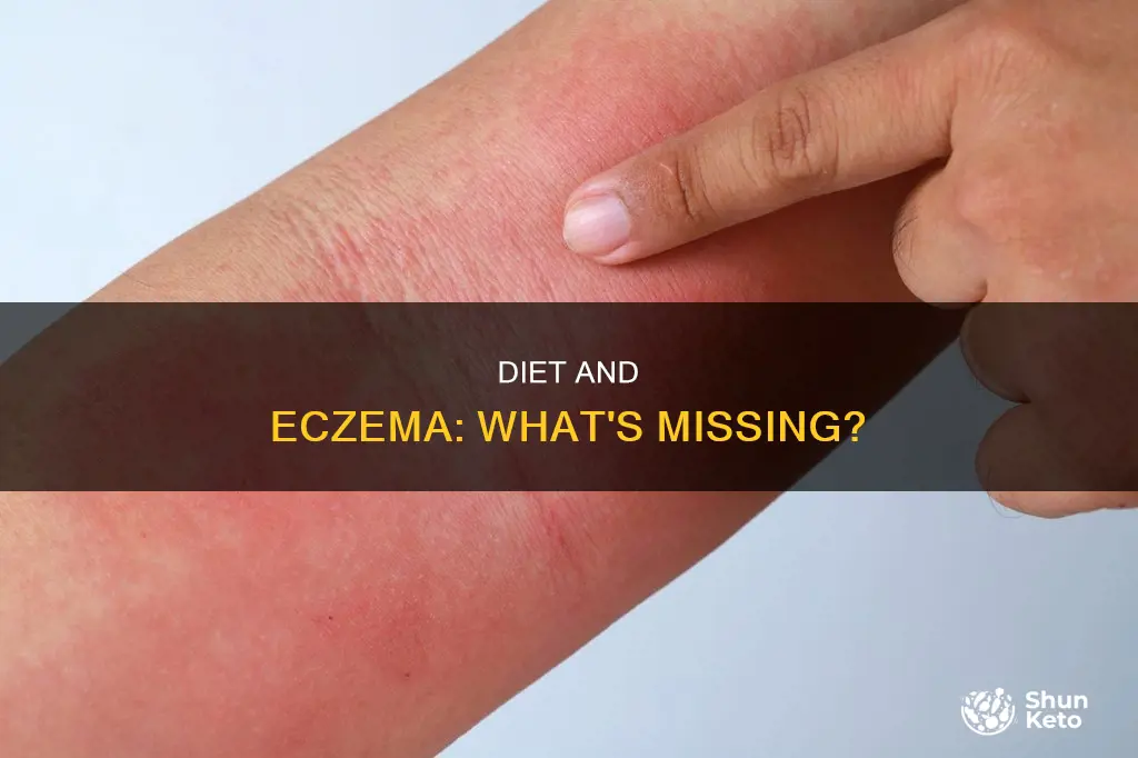 what is my diet missing to causing eczema