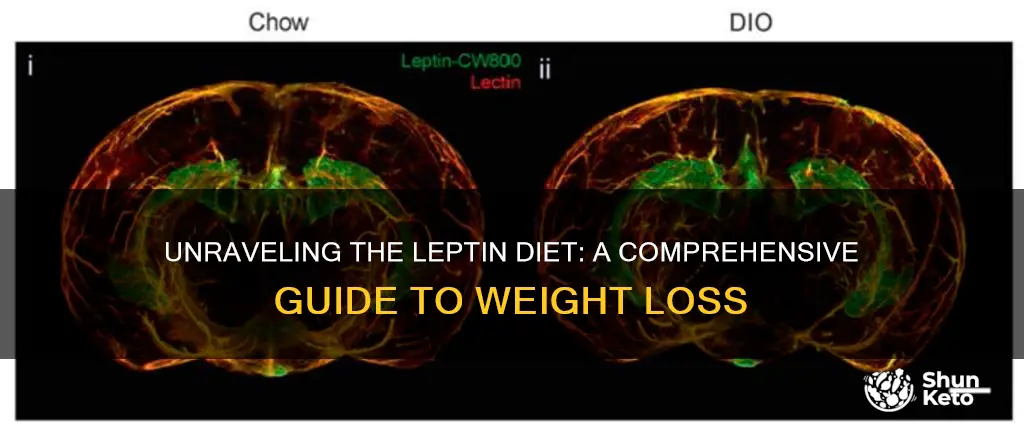 what is the leptin diet plan