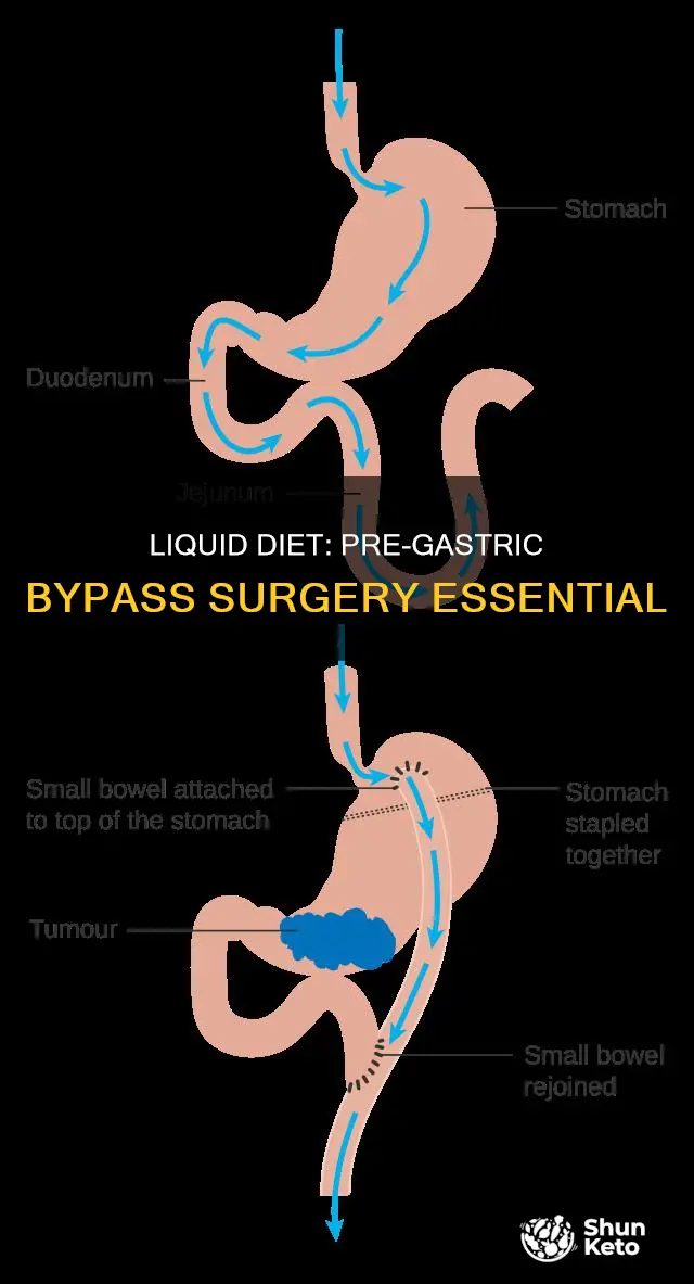 what is the liquid diet before gastric bypass
