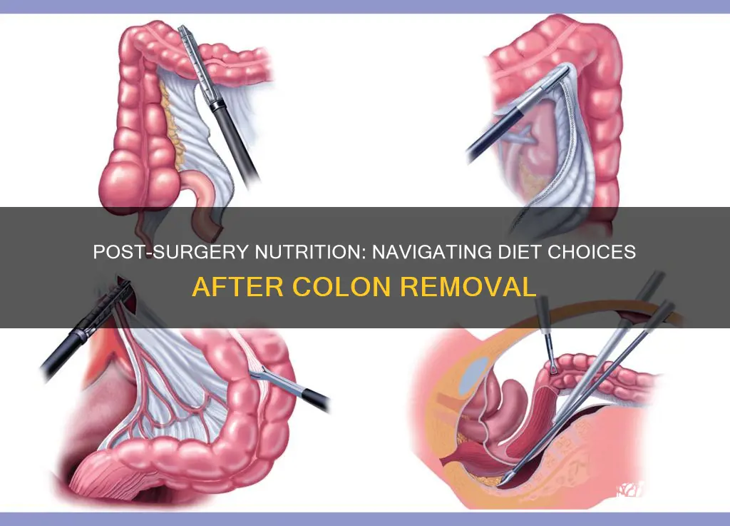 what kind of diet after colon removal surgery