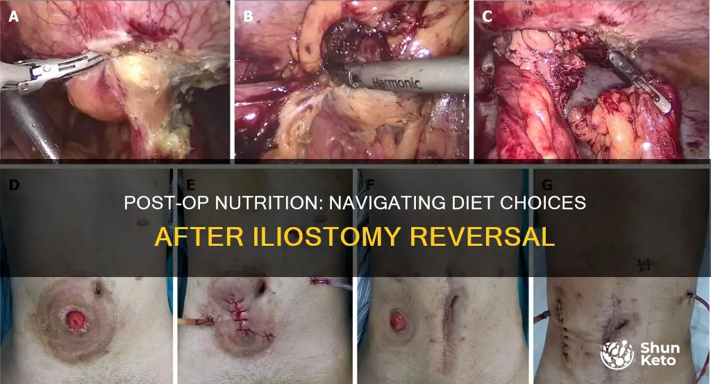 what kind of diet after reversal of iliostomy