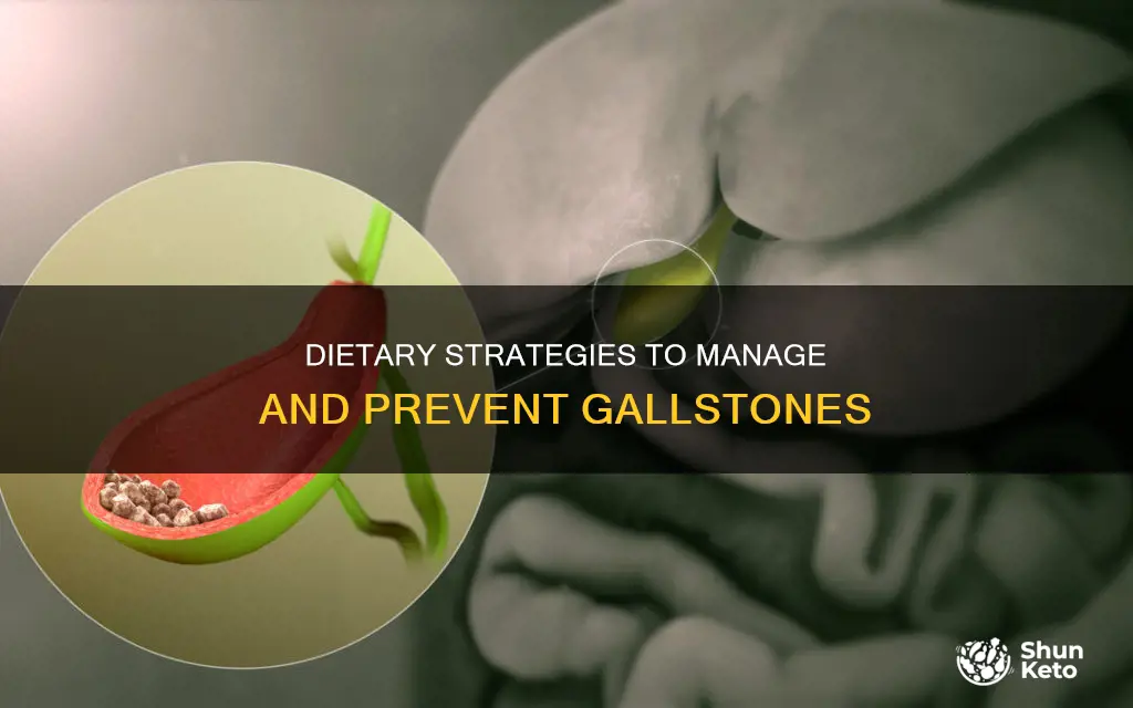 what kind of diet for gallstones