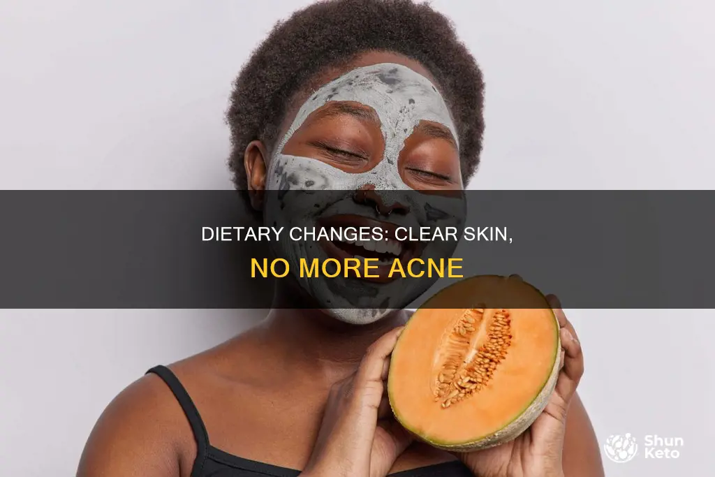what to cut out of your diet to help acne