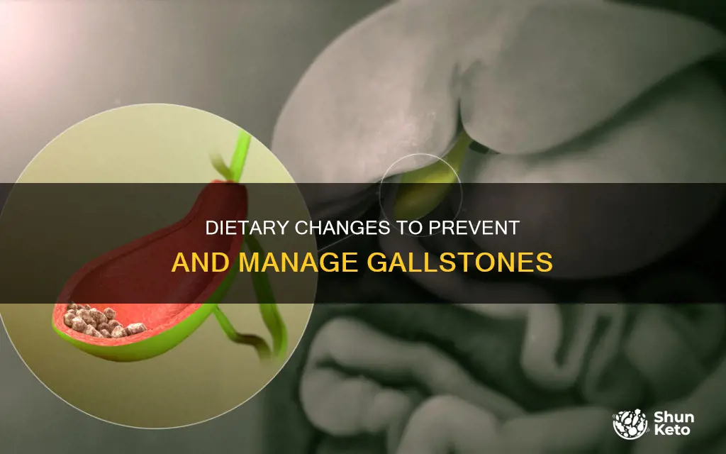 what type of diet for gallstones
