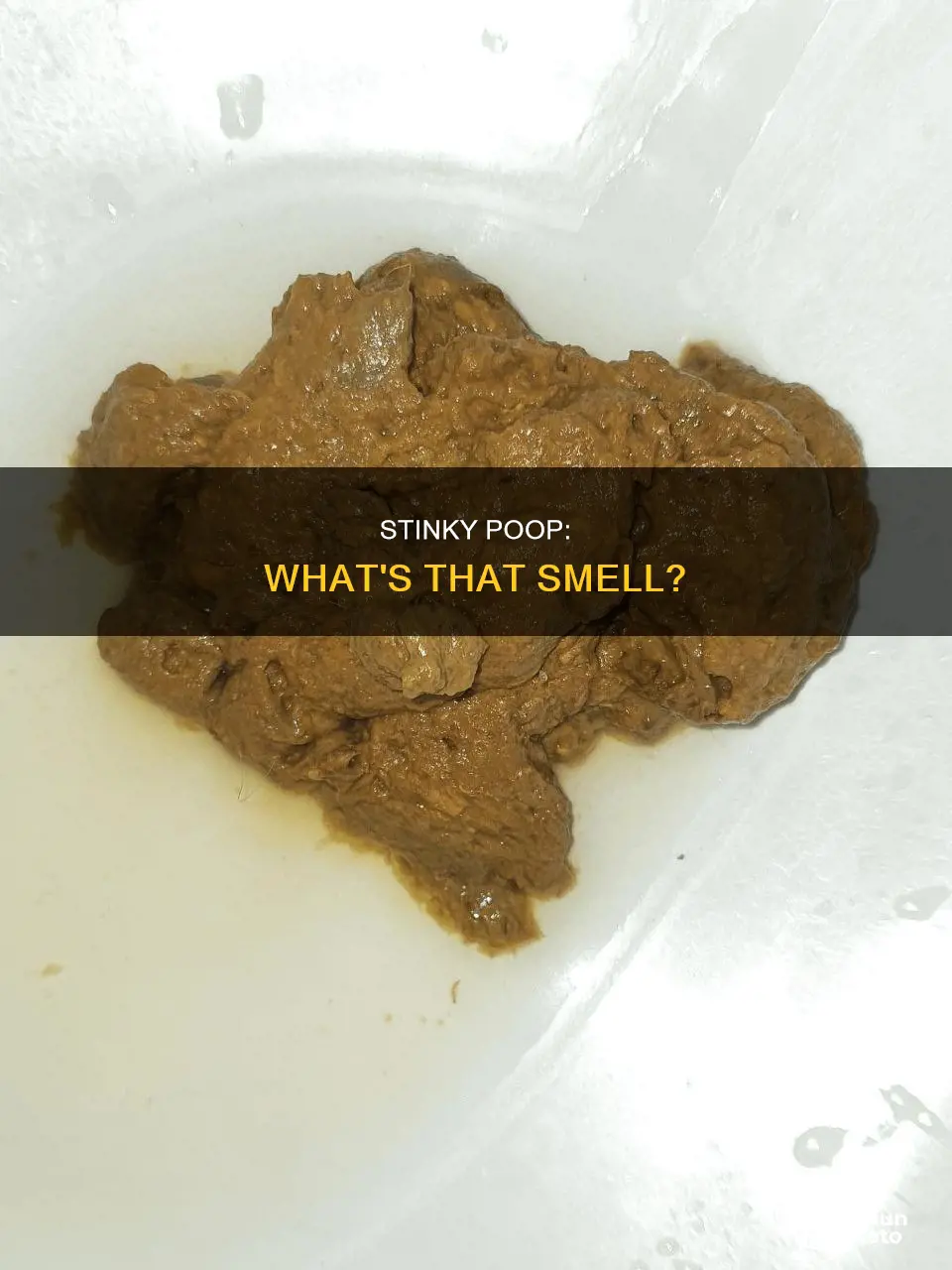 what will cause an abnormal stool odor other than diet