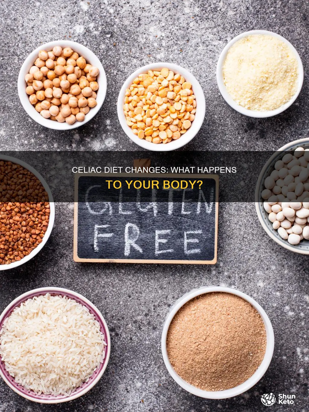 when a celiac changes their diet does their