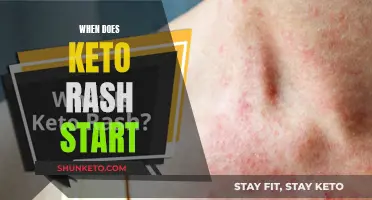 Keto Rash: When It Starts and What to Do