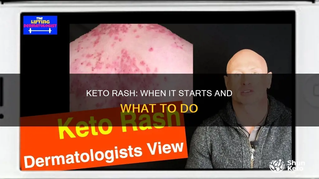 when does keto rash start