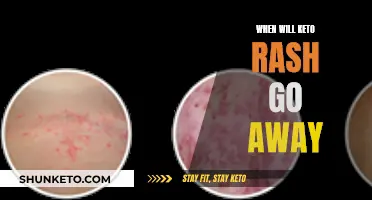 Keto Rash: How Long Does It Last?