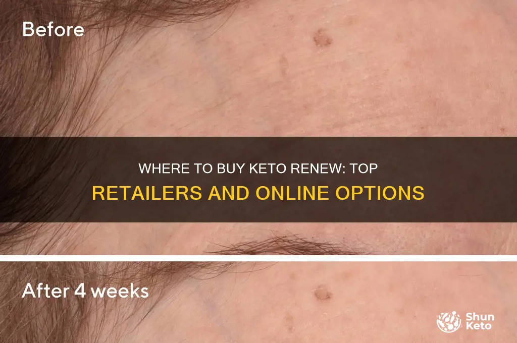 where can i buy keto renew
