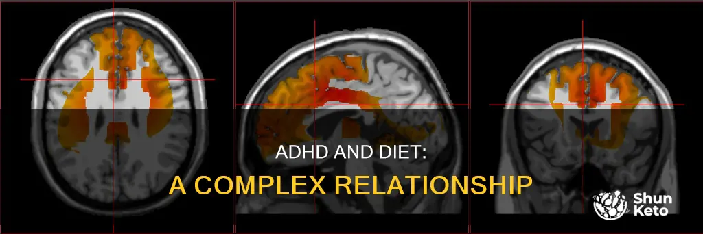 why adhd is based off of diet